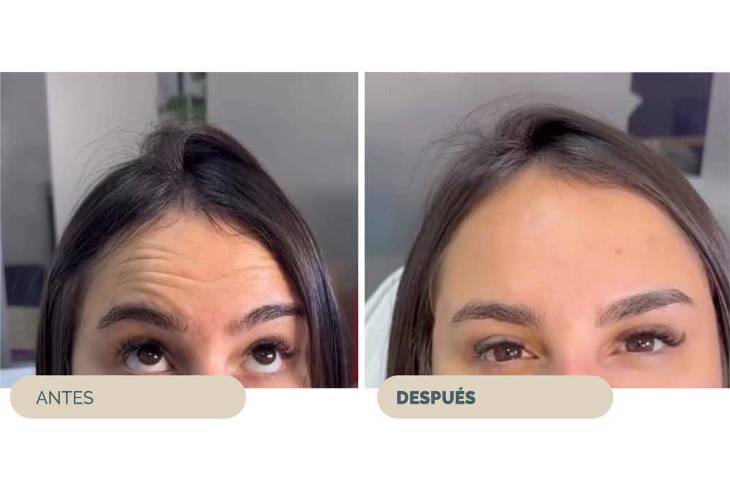 RENOVA CLINIC URUGUAY